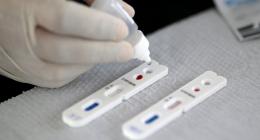 Uberlândia recebe 25,6 mil testes rápidos para diagnóstico da covid-19